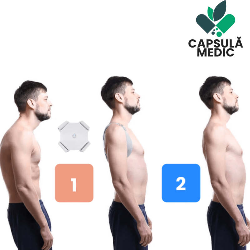 Smart Posture Corrector