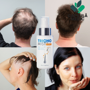 Trichomist Forte Rezultate