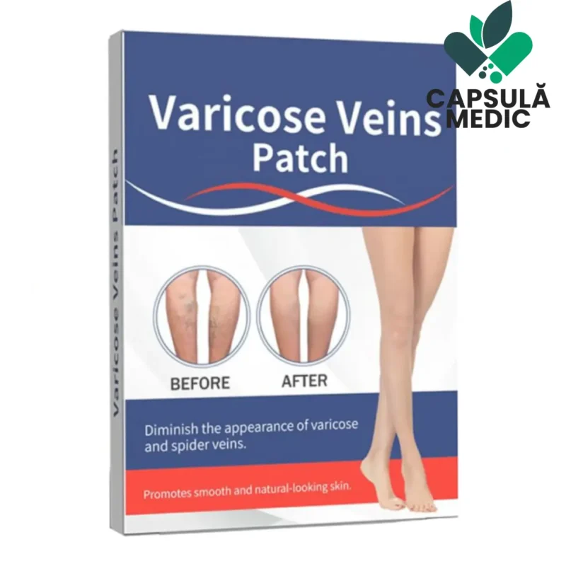 Varicose Veins Patch Varicose Veins Patch